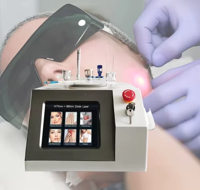 1470nm + 980nm Endolift Device